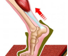 跟腱.jpg 跟腱.jpg