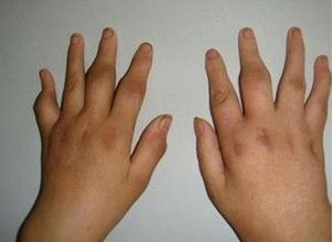 timg (4) timg (4)